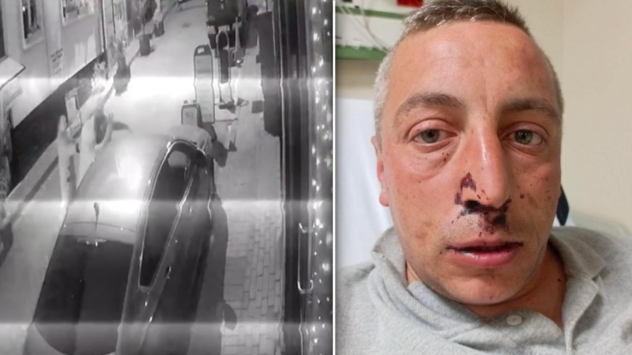 Bu nasıl vicdansızlık! Kocaeli’de engelli vatandaşa sokak ortasında saldırı