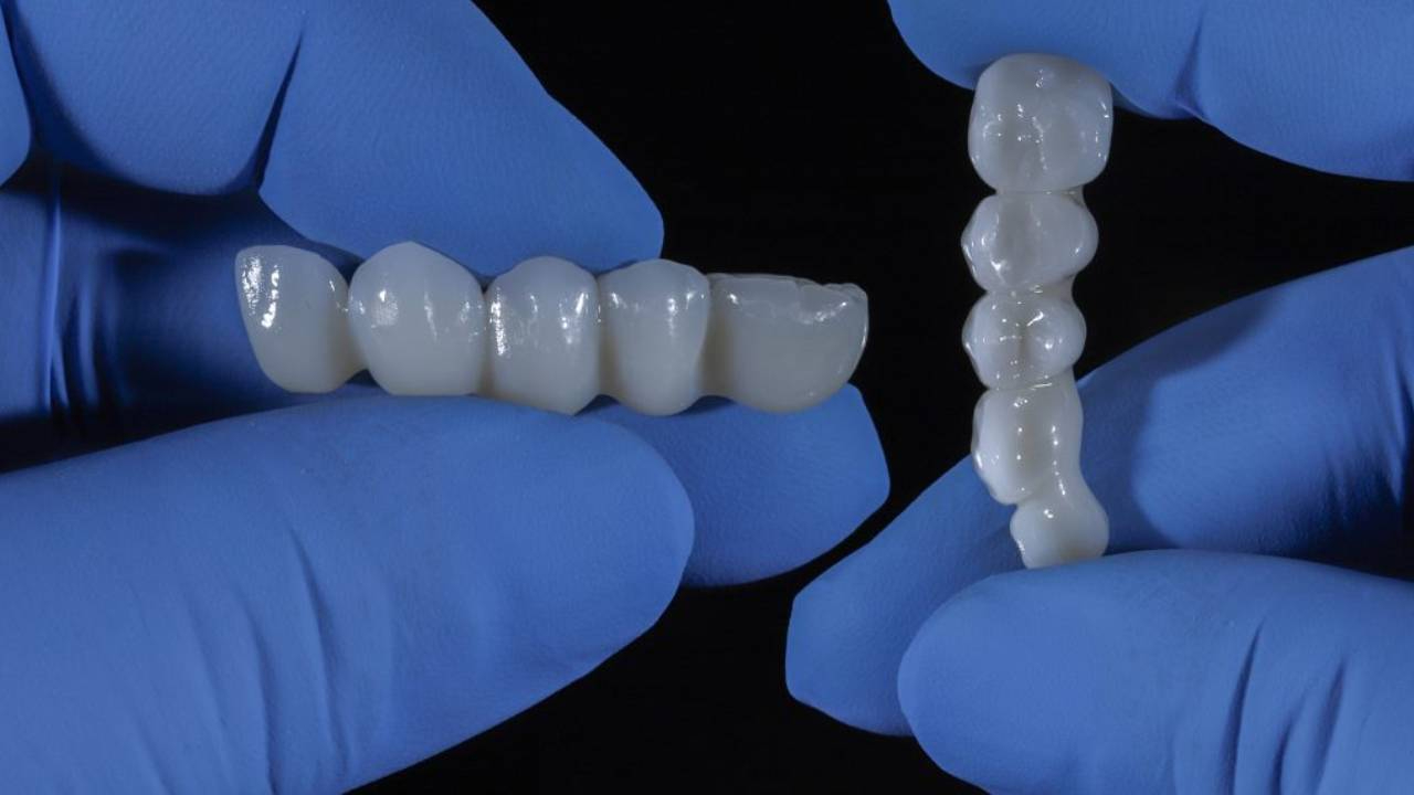Bilim insanları laboratuvarda insan dişi üretti: Dolgu ve implantların yerini alabilir