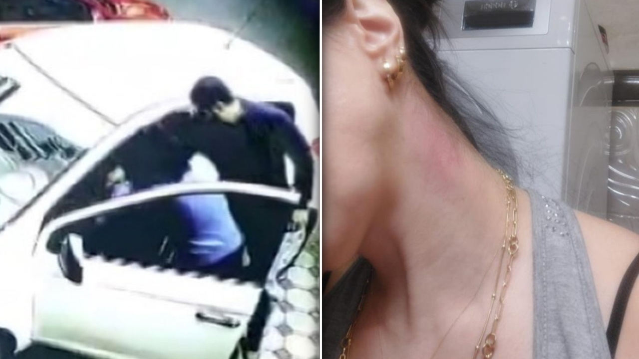 Kartal’da park yeri kavgası: Astım hastası kadın komşuları tarafından darp edildi!
