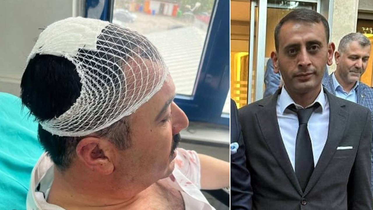 YRP'li siyasetçi, Dulkadiroğlu Belediye başkanı yardımcısının şekerlikle kafasını yardı