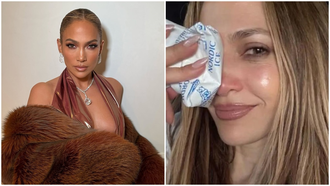 Jennifer Lopez, prova sırasında kaza geçirdi! Yüzüne dikiş atıldı