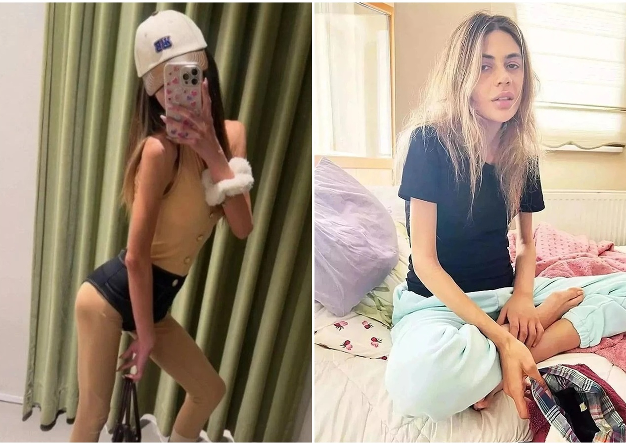 Bir deri bir kemik kalan Nihal Candan'dan şoke eden açıklama: Hayvanlar fiyatı bilinsin diye sürekli tartılırlar