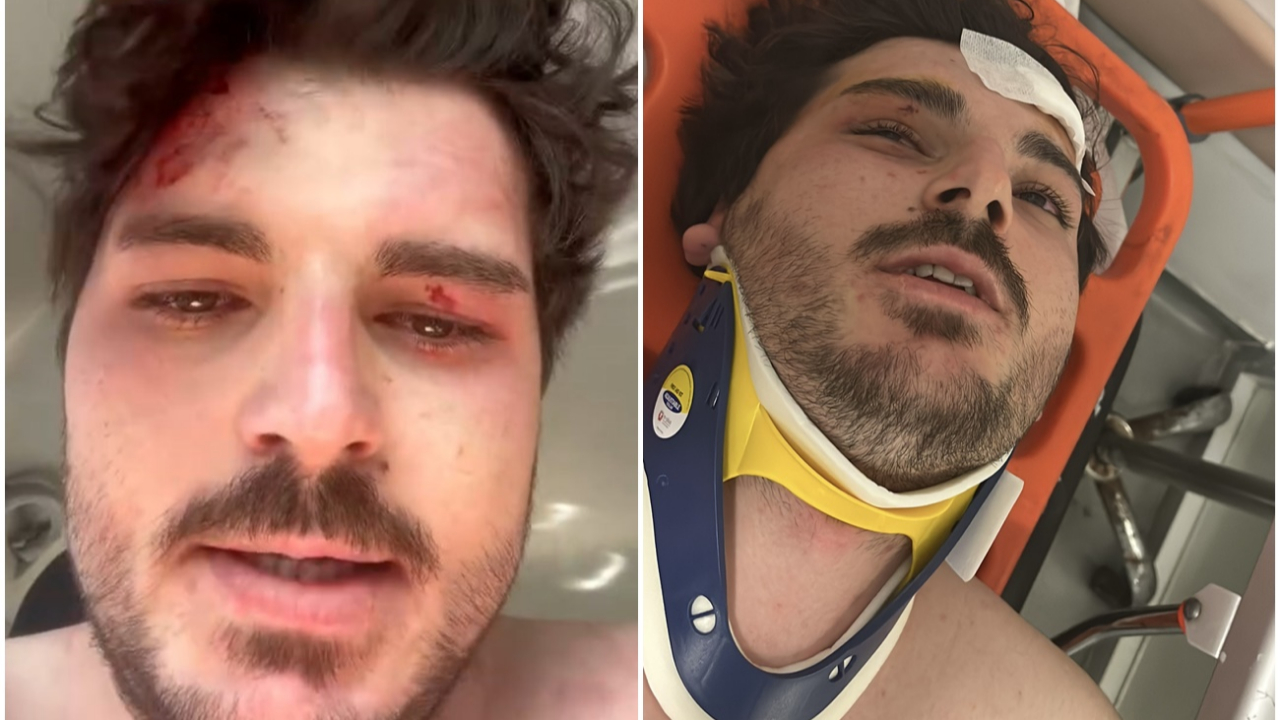 Trafik 4 kişinin saldırısına uğrayan oyuncu Mehmet Akif Akdeniz, yaşadığı korku dolu anları anlattı