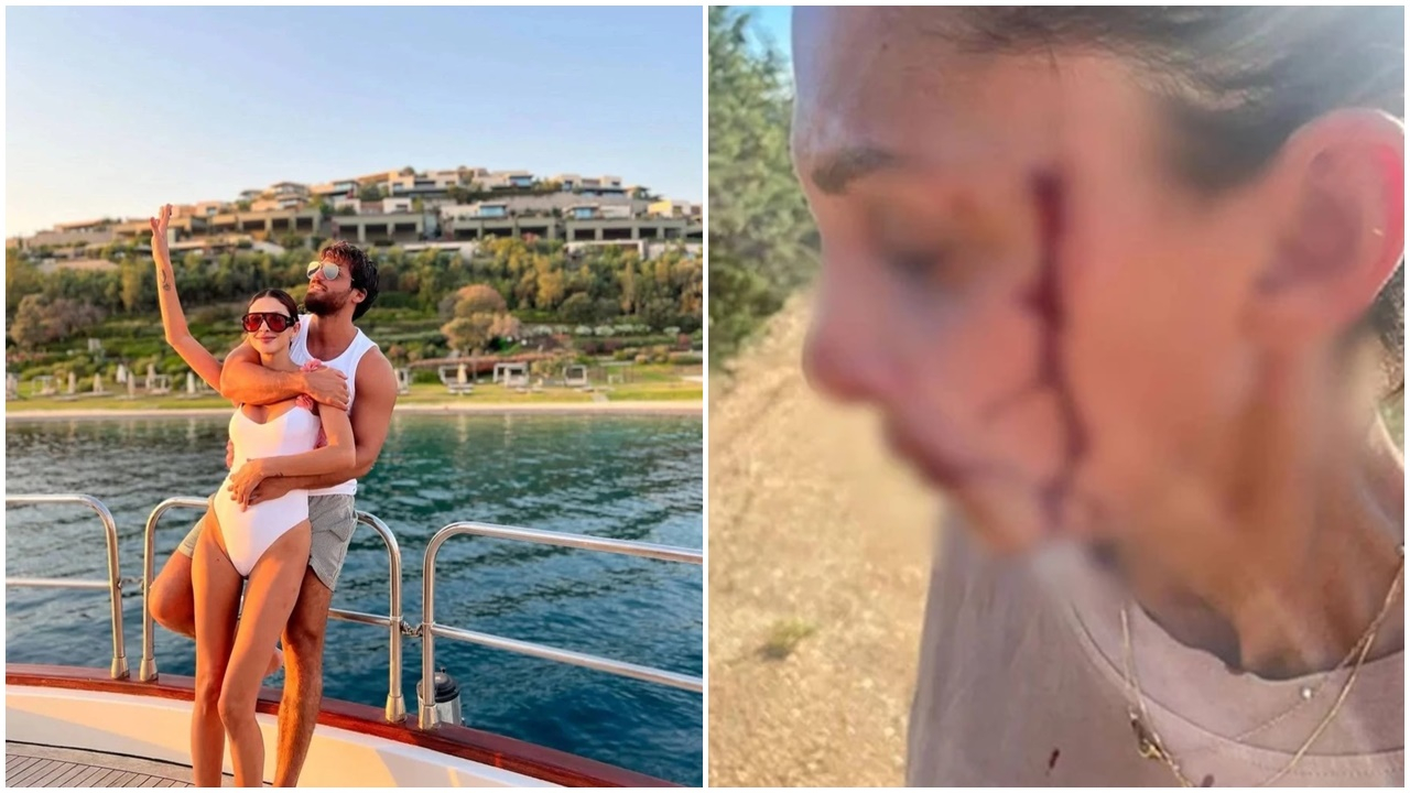 Can Yaman'ın sevgilisi Sara Bluma kanlar içindeki halini paylaştı! ''Şiddet görüyorum''
