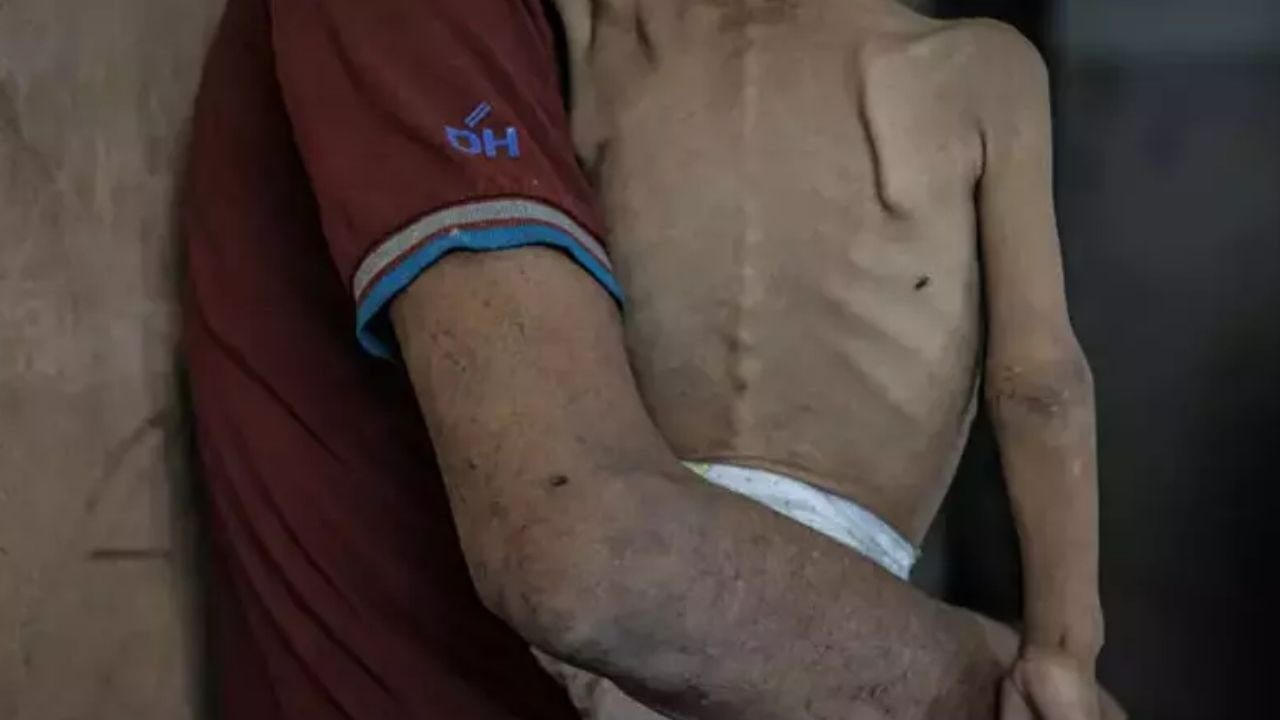 Gazze'de açlık savaş silahı! Korkunç rapor!