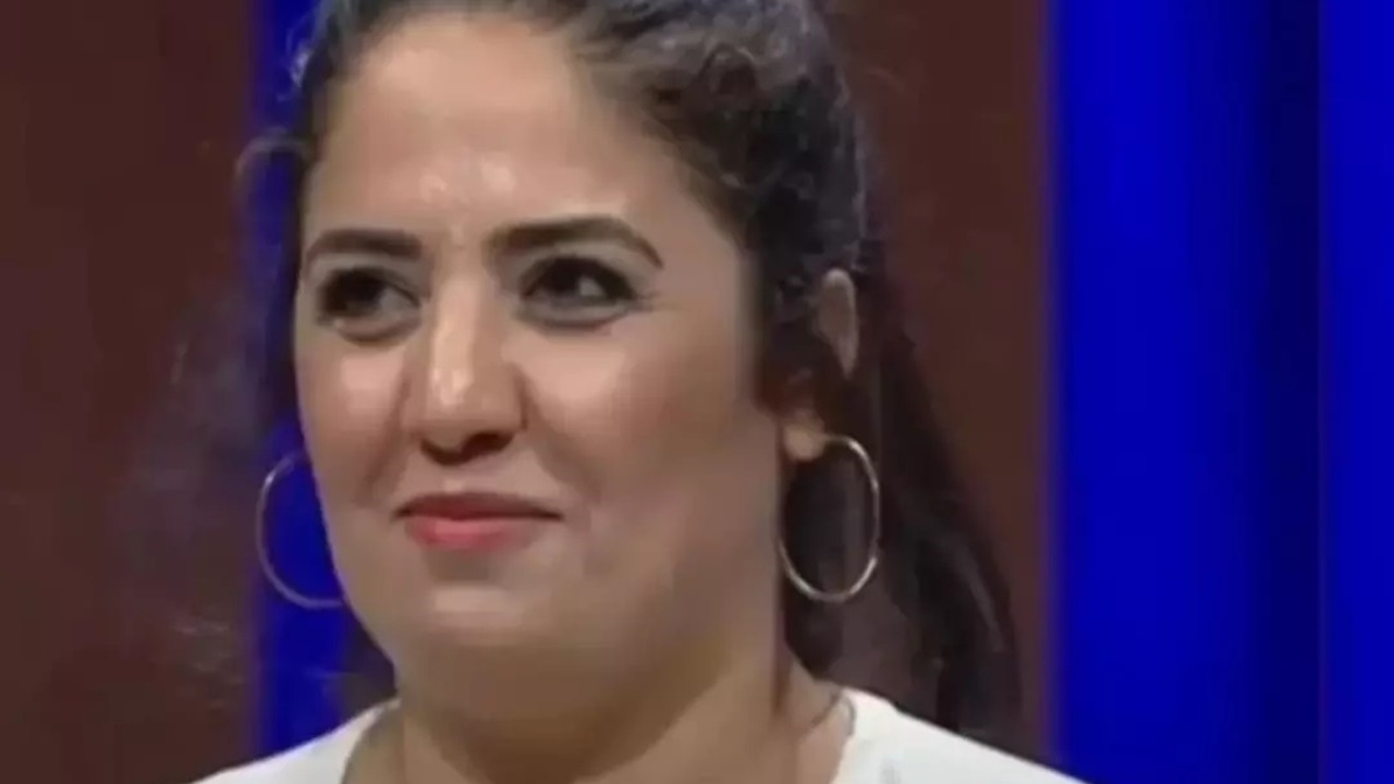 Azize Polat’ın MasterChef sonrası değişimi görenleri şaşırttı! Estetik operasyonlarla bambaşka biri oldu