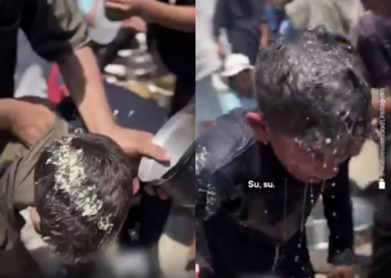 Yürek yakan anlar... Gazze'de ailesine yemek götürmek isteyen çocuk yandı