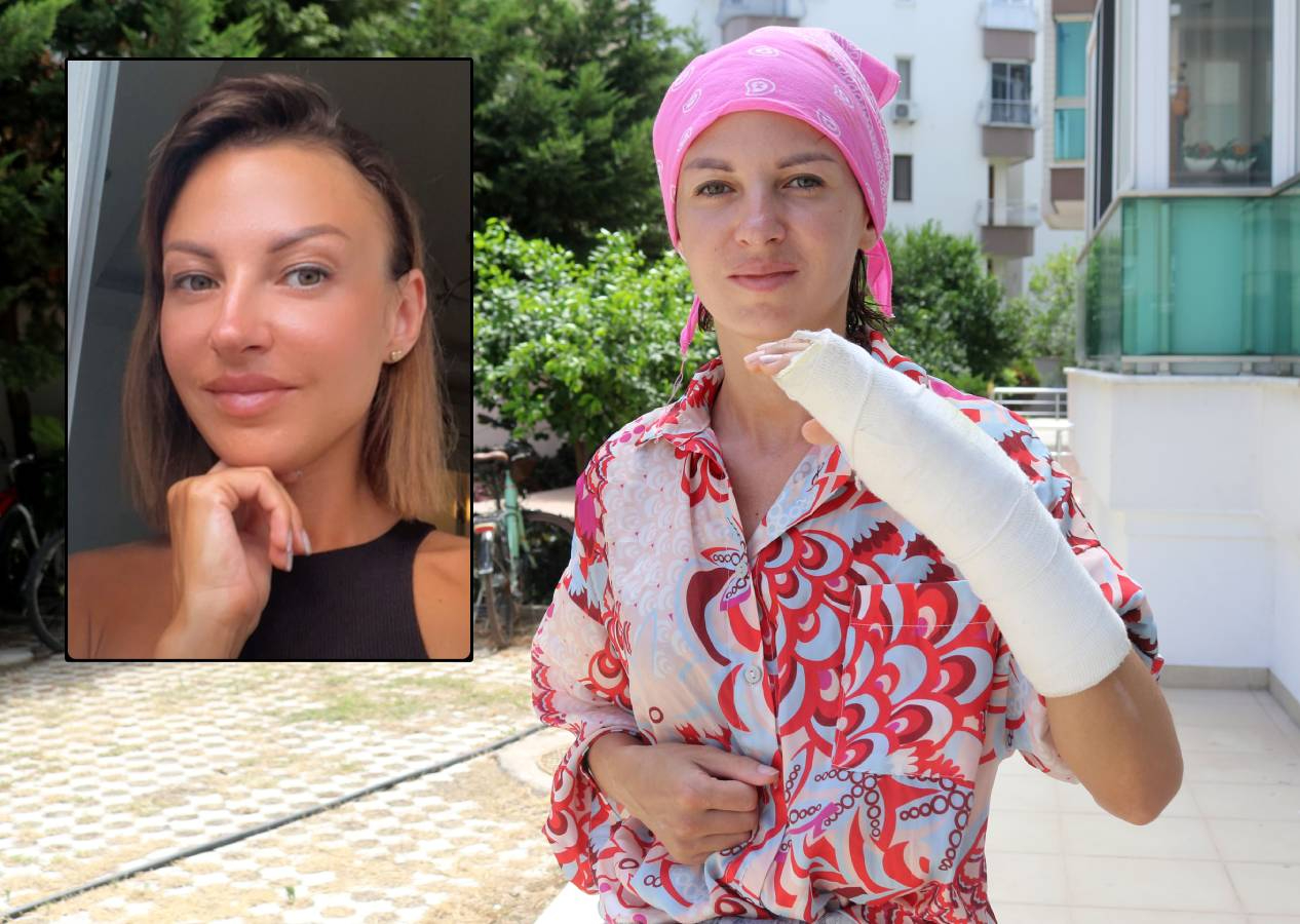 Ukraynalı eski eşi Irina'ya sopayla saldırdı, hastanelik etti! "Öldüreceğim" diyerek defalarca vurdu