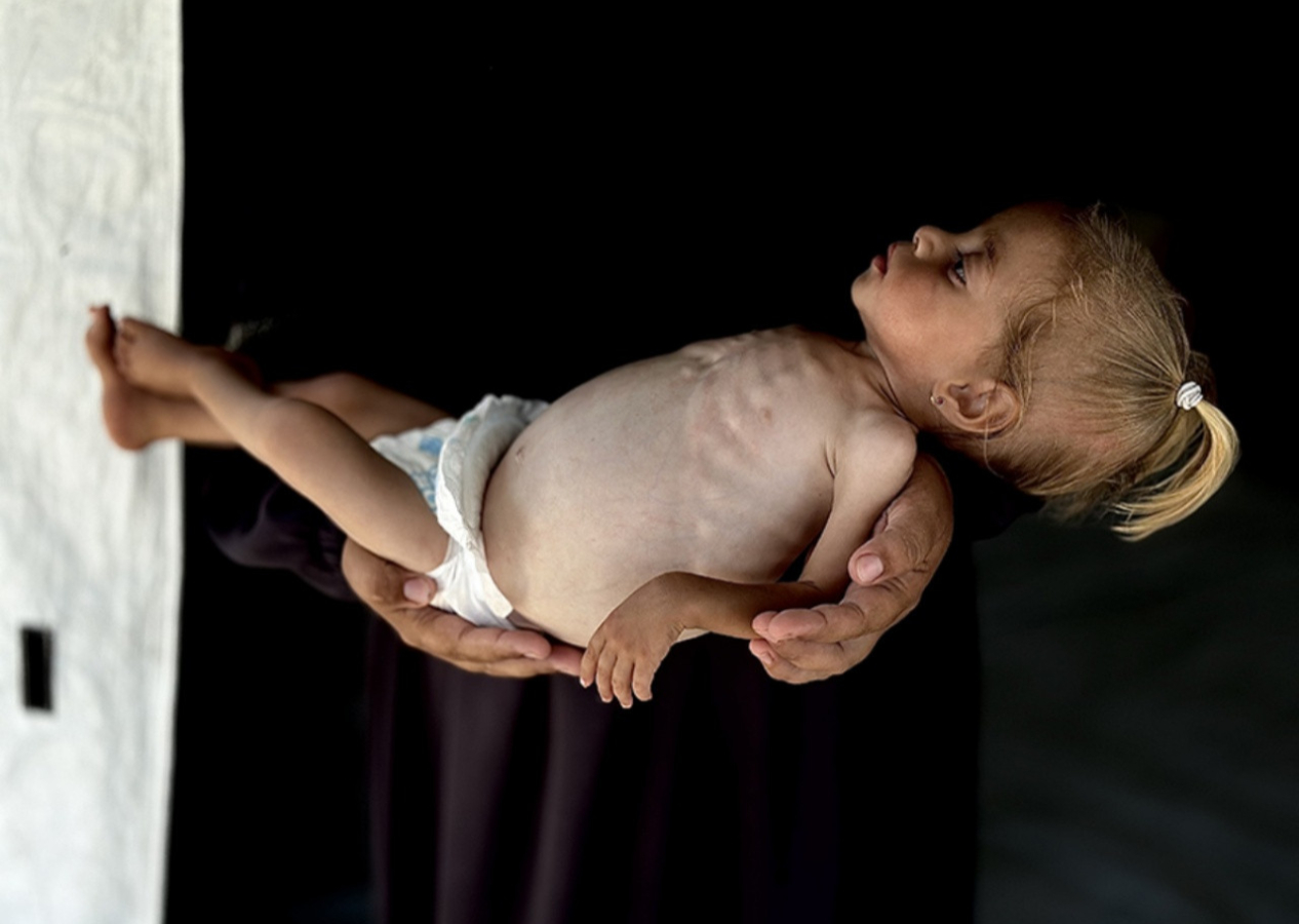 Aç çocuklara yenildiler! Gazze'deki insanlık dışı görüntüler İsrail'i yalnızlaştırıyor... 31 Temmuz Perşembe gazete manşetleri!
