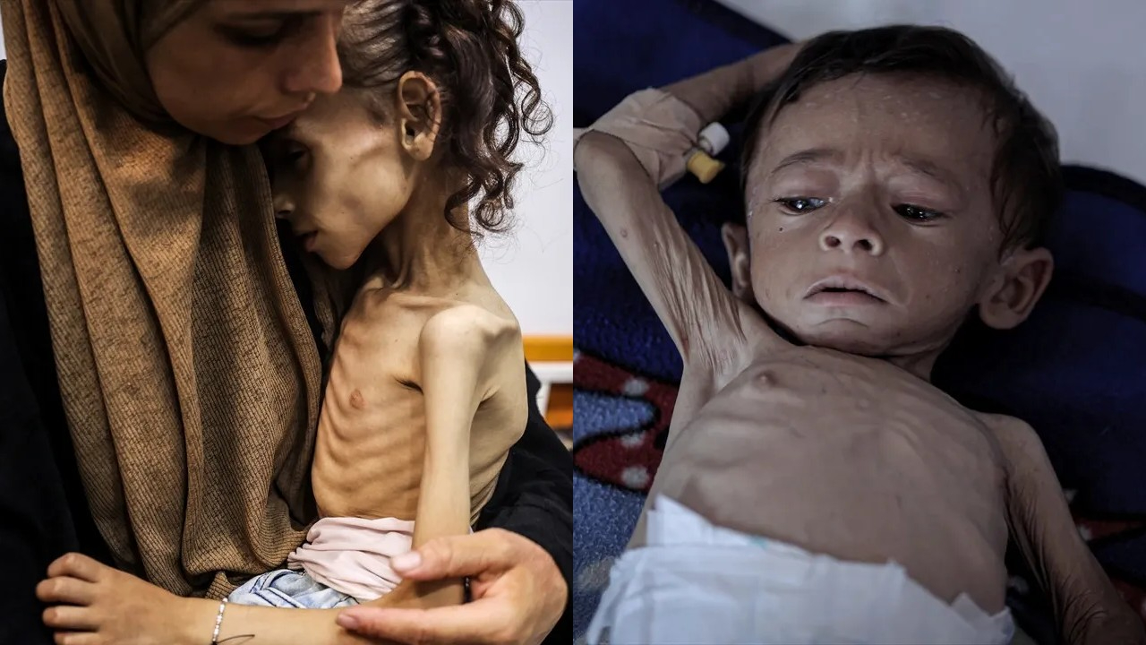 Gazze'de açlıktan ölenlerin sayısı gün geçtikçe artıyor