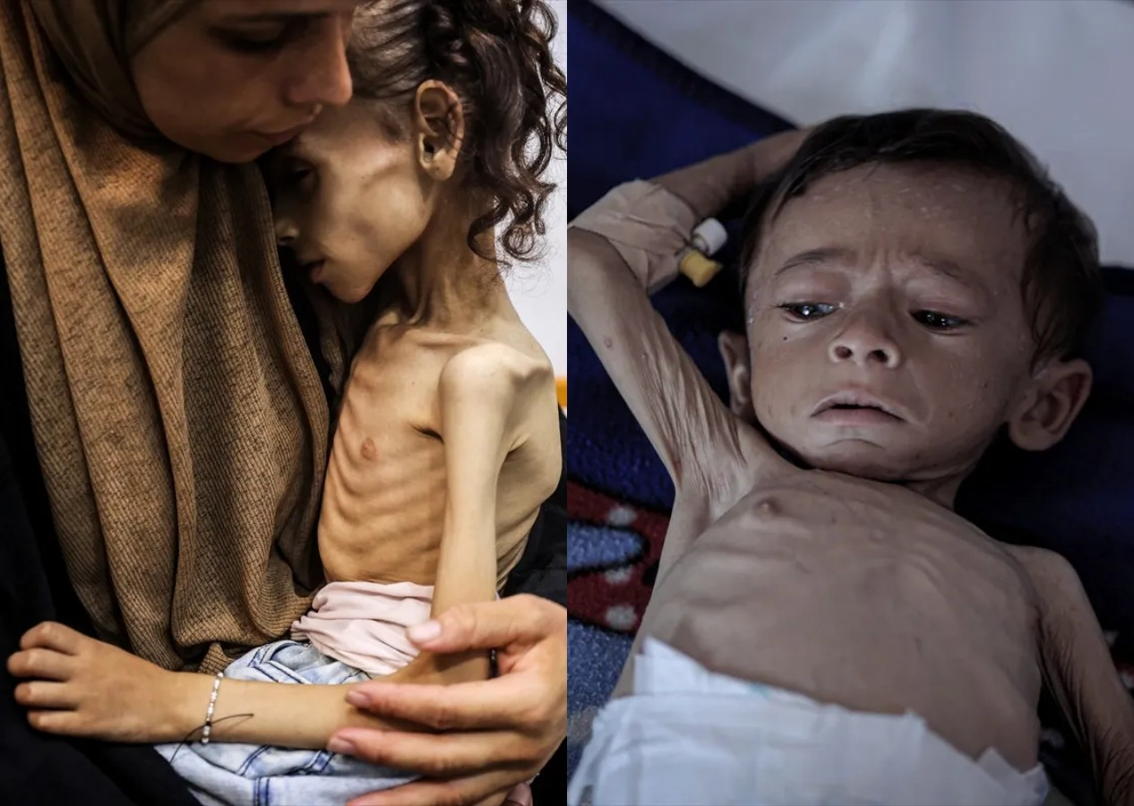 Gazze'de açlıktan ölenlerin sayısı gün geçtikçe artıyor