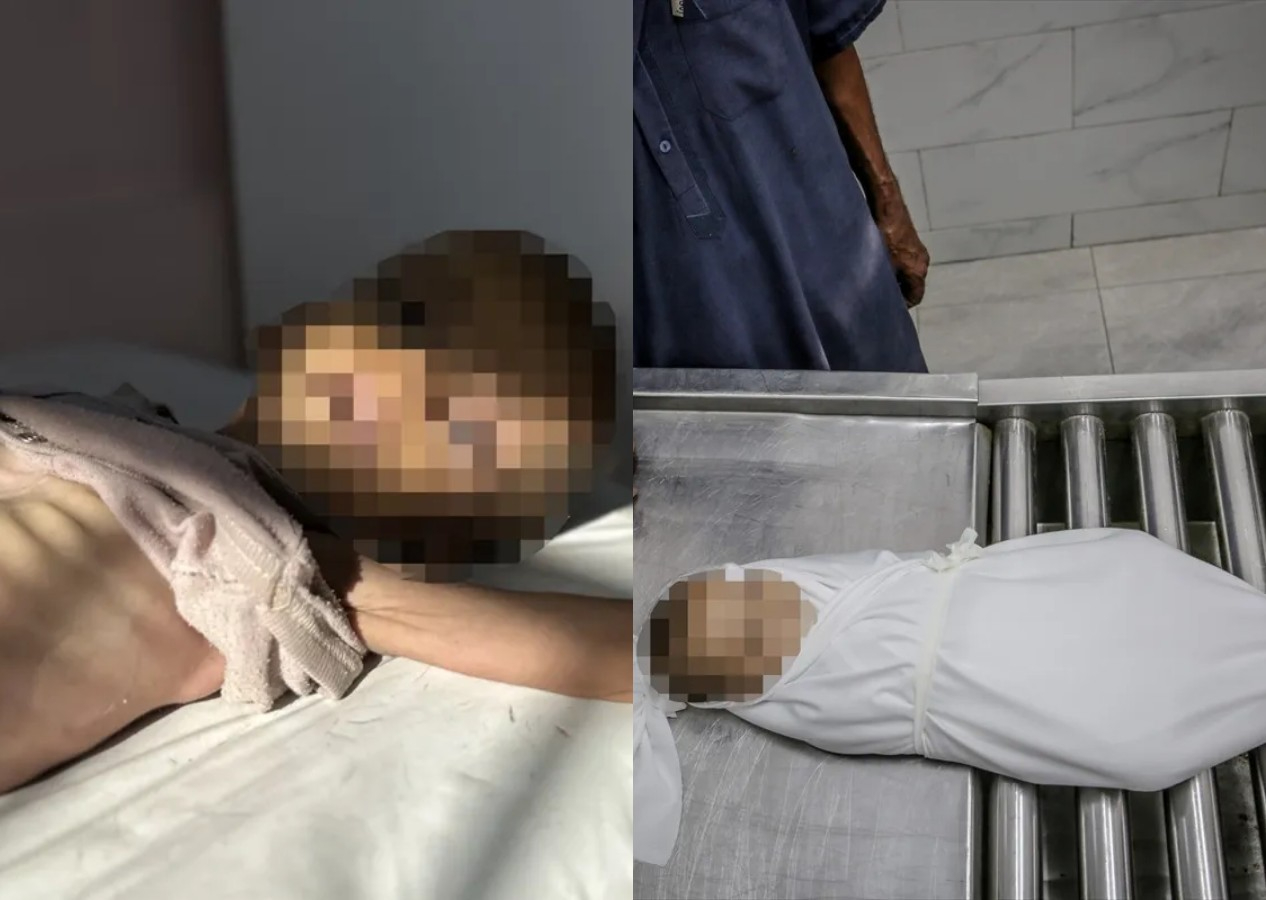 Gazze'de soykırım var! 11 kişi açlıktan hayatını kaybetti