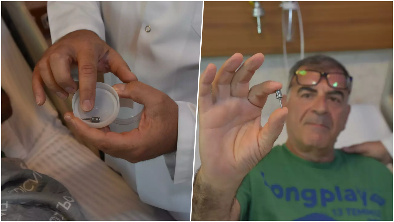 Öksürük şikayetiyle gittiği hastanede duyduklarına inanamadı! Akciğerinden diş implantı çıktı