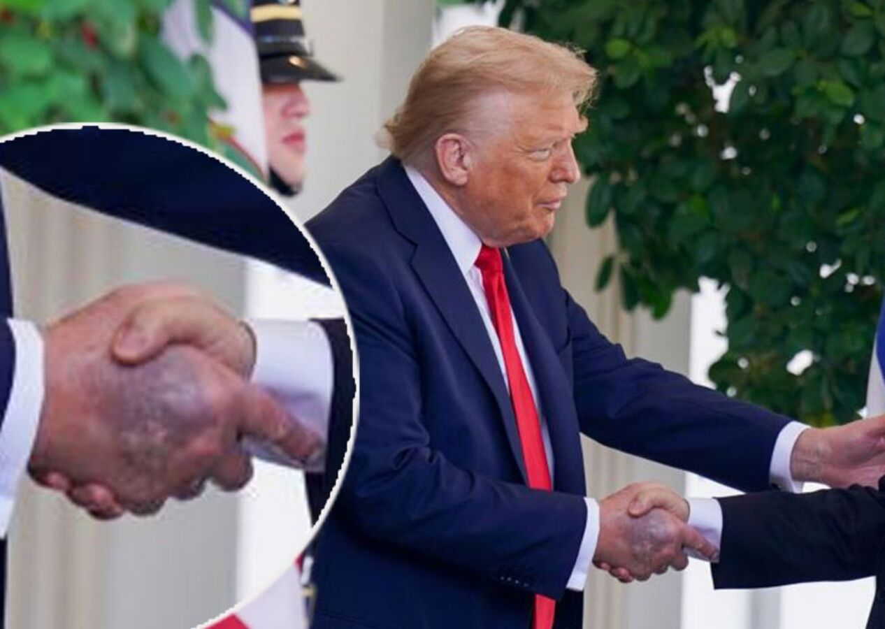 Donald Trump'ın elindeki gizemli morluk tekrar ortaya çıktı!