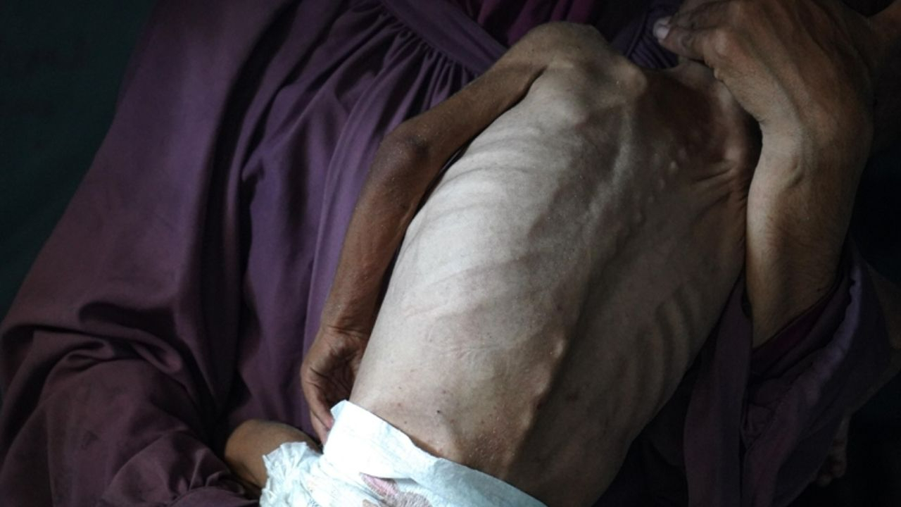 Gazze’de açlık felaketi: Son 24 saatte 6 kişi daha hayatını kaybetti