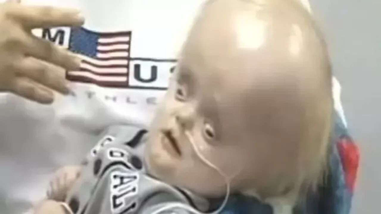 Trevor judge waltrip kimdir, nereli? Hangi organı doğuştan yoktur?