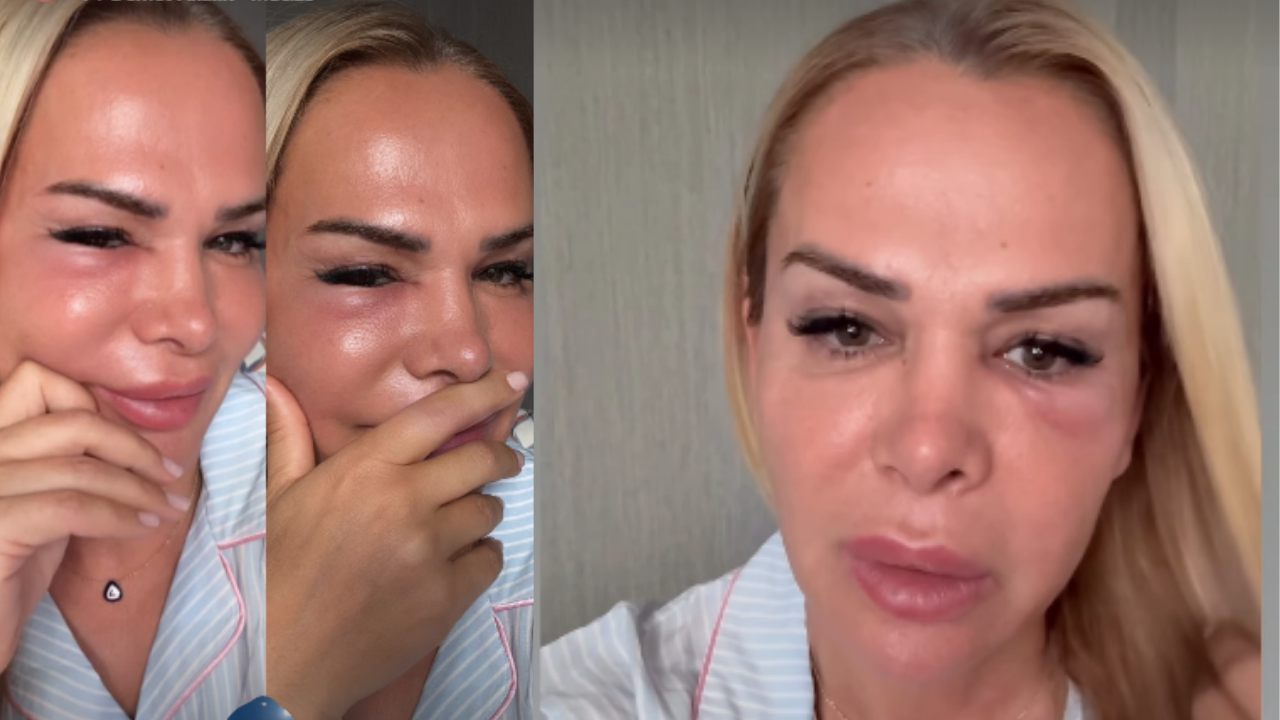Nagihan Karadere'nin yüzüne ne oldu? Kavgaya karıştı iddiası