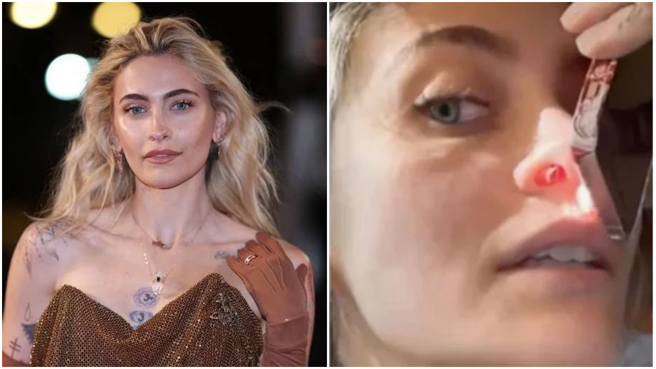 Michael Jackson'ın kızı uyuşturucu madde kullandığı için burnunda açılan üçüncü deliği paylaştı