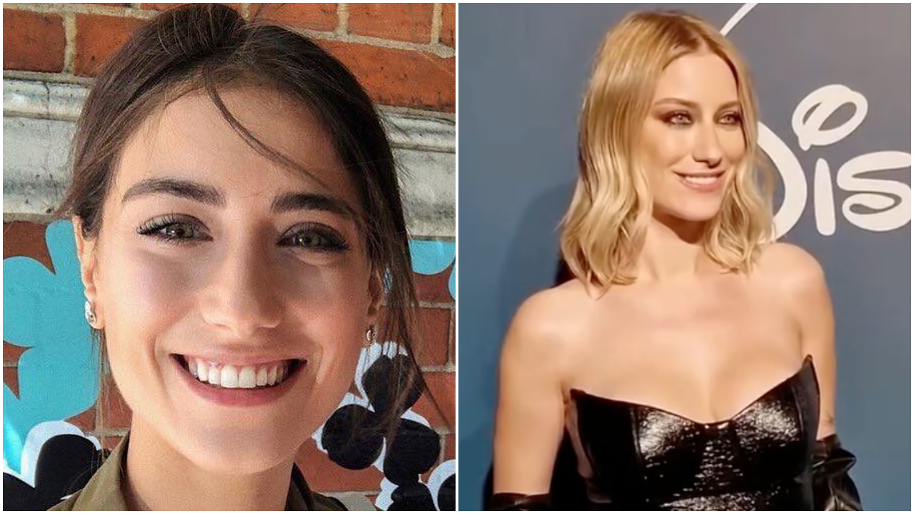 Hazal Kaya'nın diş estetiği krizi! 'Eski hali daha güzeldi'