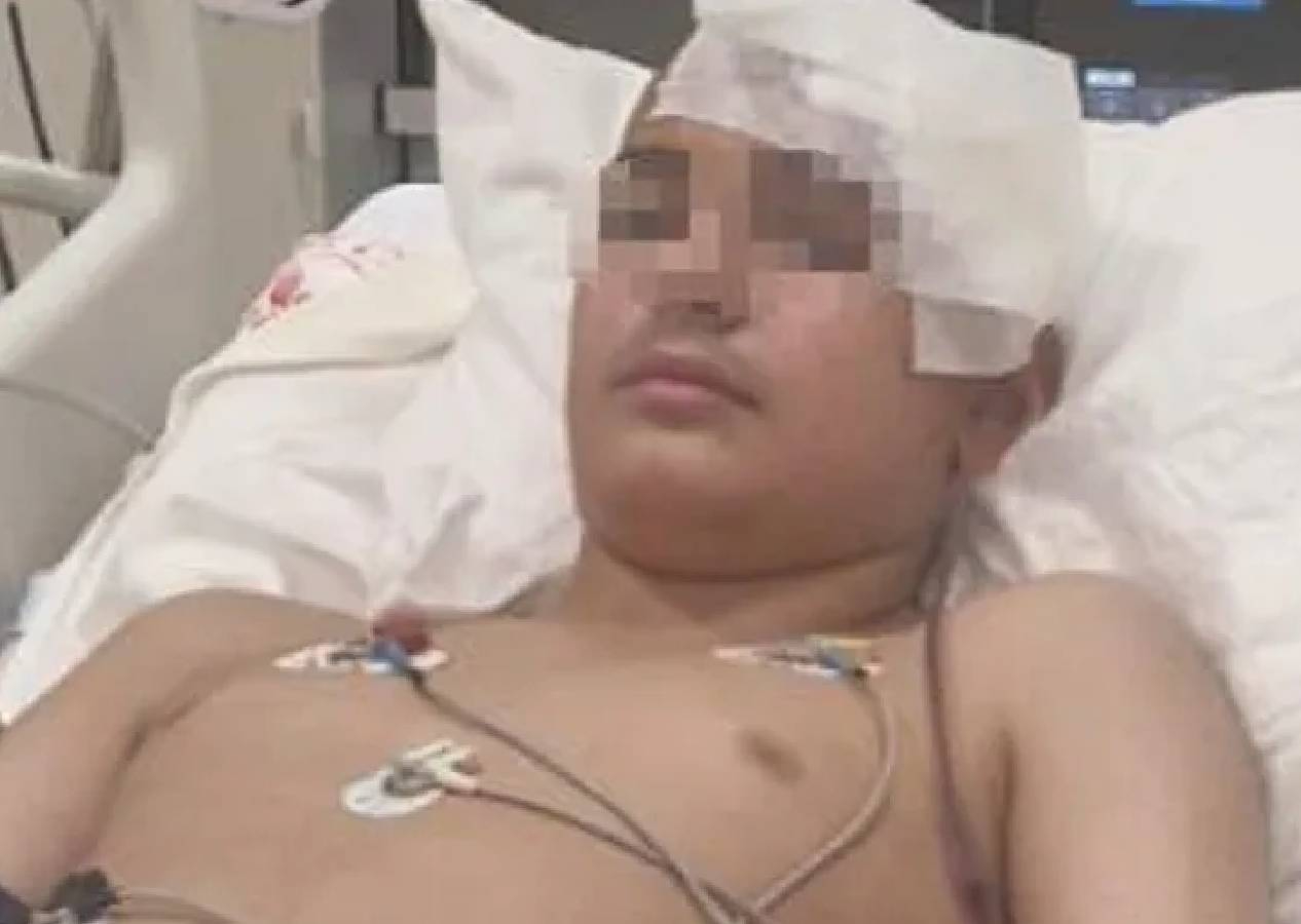 Akran şiddeti komaya soktu! 13 yaşındaki çocuğun kafatası titanyumla yeniden yapıldı