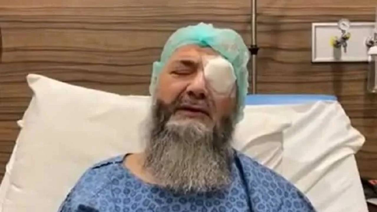 Canlı yayında açıkladı! Cübbeli Ahmet Hoca sol gözünü mü kaybetti?
