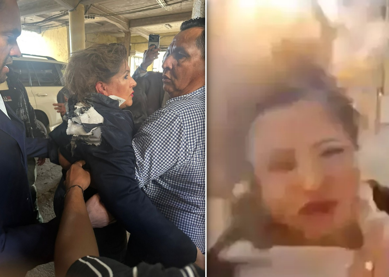 Seçim krizi büyürken Kongre binasında saldırı: Honduras'ta basın toplantısında milletvekiline patlayıcı attılar! İşte o anlar...
