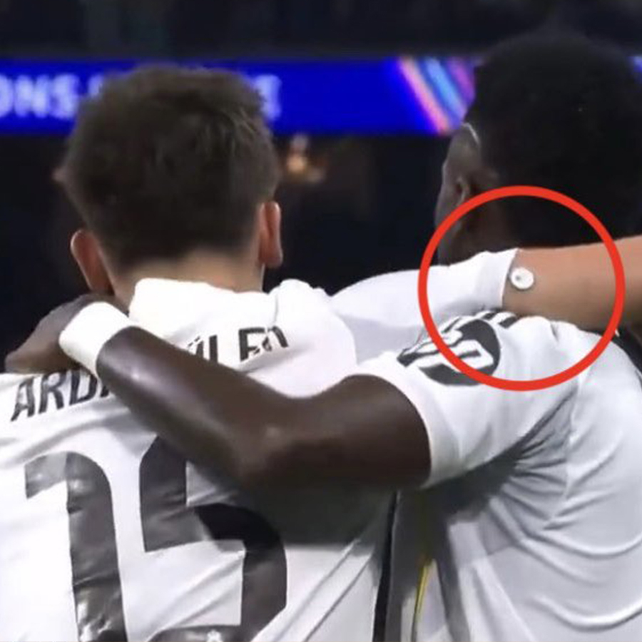 Arda Güler'in kolundaki sağlık cihazı ne işe yarıyor?