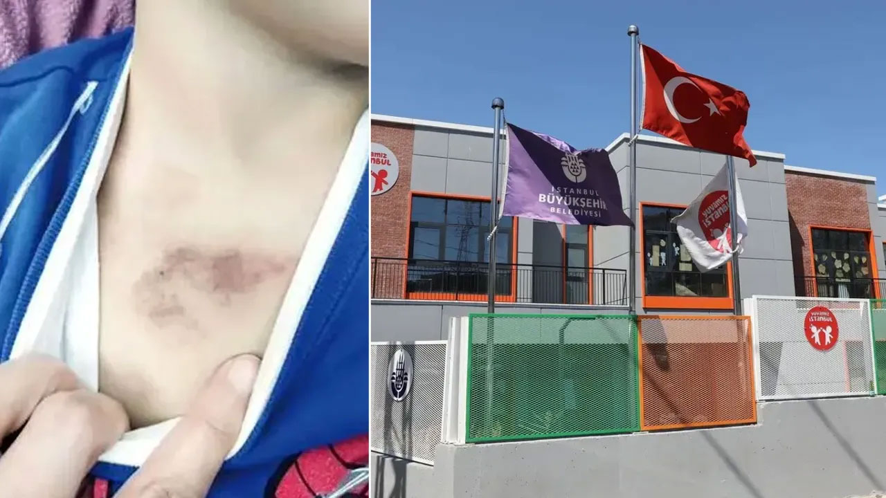İBB suçluları mı koruyor? 3 yaşında çocuğa şiddet olayında gerçeklerin üzeri örtülüyor