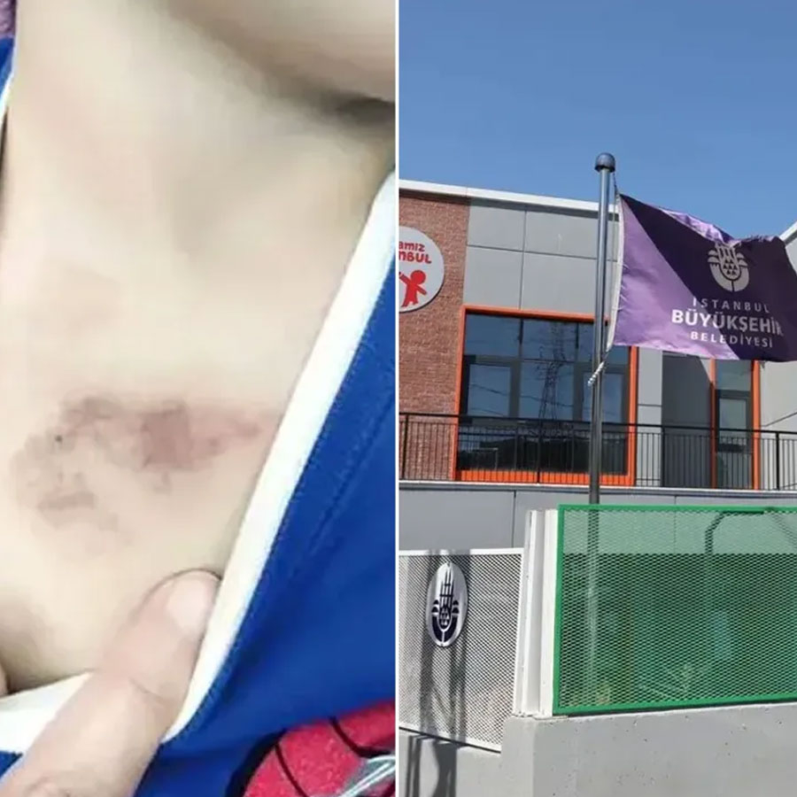 İBB suçluları mı koruyor? 3 yaşında çocuğa şiddet olayında gerçeklerin üzeri örtülüyor