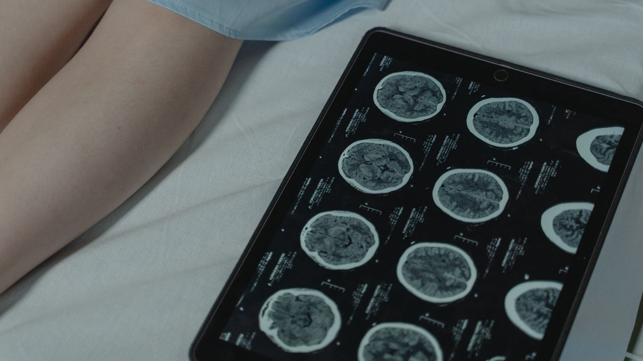 Epilepsi nöbeti sırasında ne yapılmalı, ne yapılmamalı?