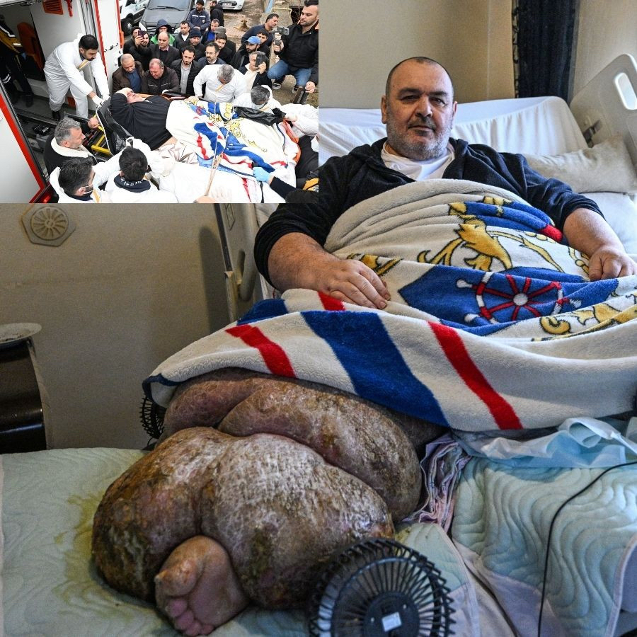 Kayseri'de 300 kiloluk fil hastası, özel ekiple hastaneye taşındı