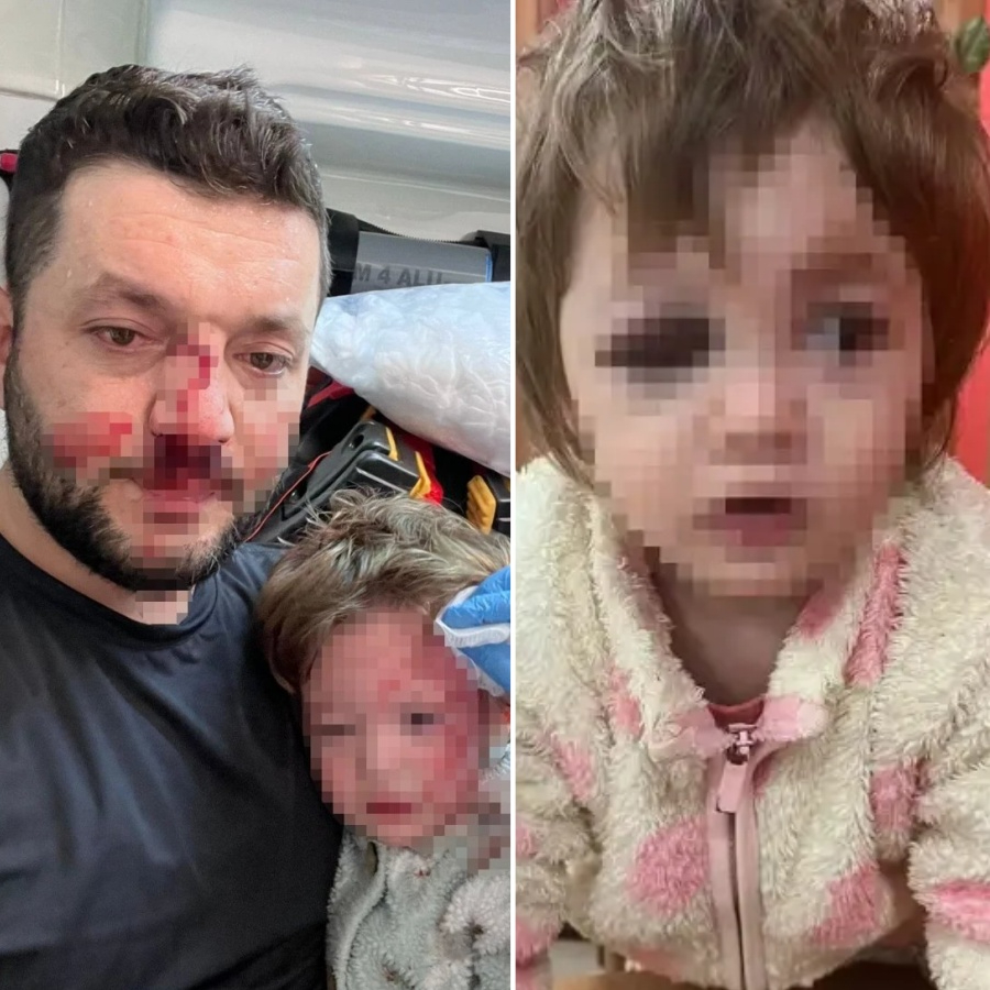 Türkiye, Yalova'daki komşu dehşetini konuşuyor! 14 aylık bebeği ve babasını sopayla darbetti! Bakan Gürlek duruma el koydu: Süreç titizlikle takip ediliyor!
