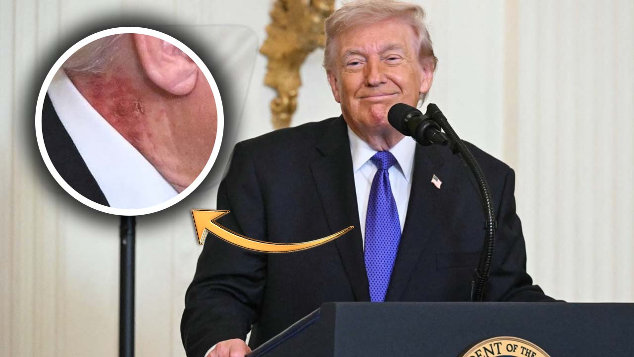Sosyal medya bu görüntüyü konuşuyor! Trump'ın boynundaki yara izinin sırrı ne?