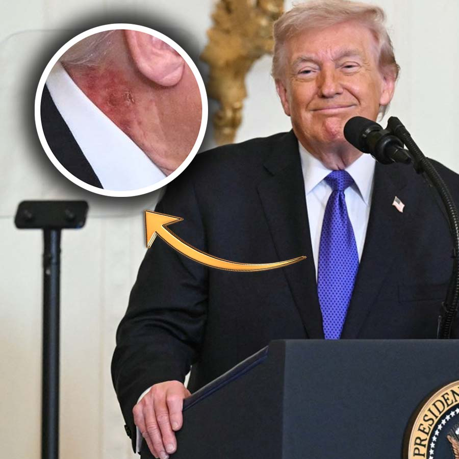 Sosyal medya bu görüntüyü konuşuyor! Trump'ın boynundaki yara izinin sırrı ne?