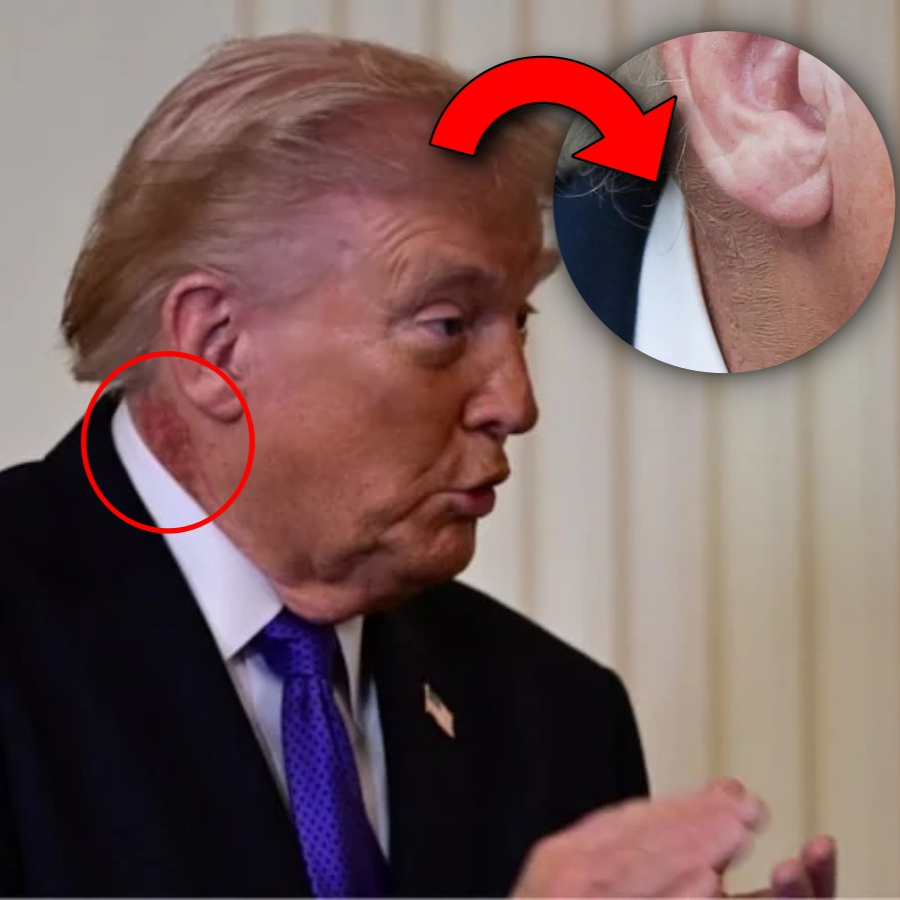Merz görüşmesine damga vuran detay! Trump boynundaki izi makyajla gizlemeye çalıştı...
