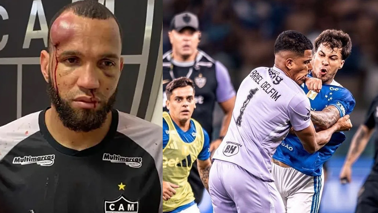 Futbol tarihinin en büyük kavgası yaşandı: 23 isim kırmızı kart gördü! Hulk rakibinin kafasına yumruk attı