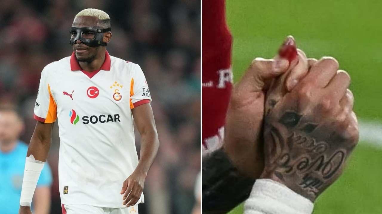 Victor Osimhen en az 1 ay sahalardan uzak kalacak