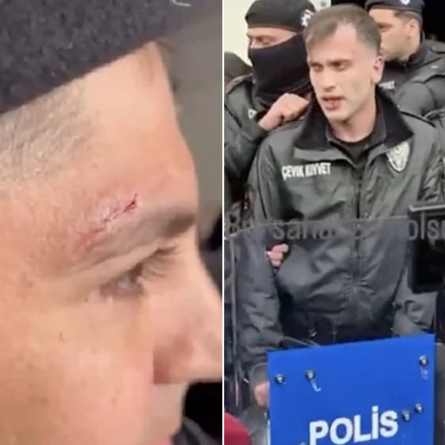 Yolsuzluğun öfkesini polisten çıkardılar: Bursa'da CHP'li grup emniyet güçlerini yaraladı!