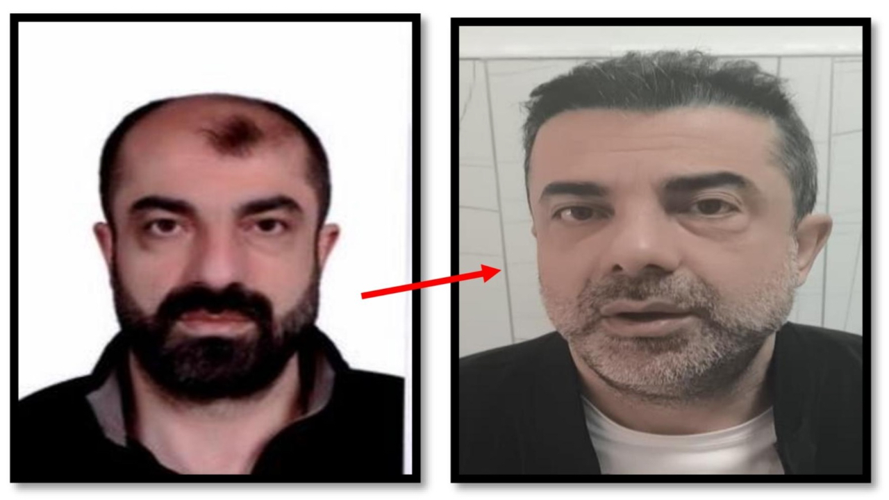 BİR GARİP OLAY! Ankara'da cinayet azmettiricisi, ameliyatla yüzünü değiştirdi! Yine de polisten kaçamadı...