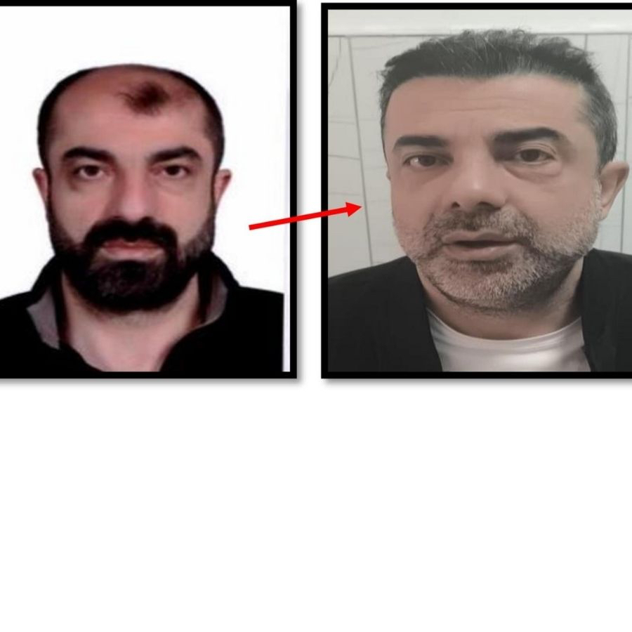 BİR GARİP OLAY! Ankara'da cinayet azmettiricisi, ameliyatla yüzünü değiştirdi! Yine de polisten kaçamadı...