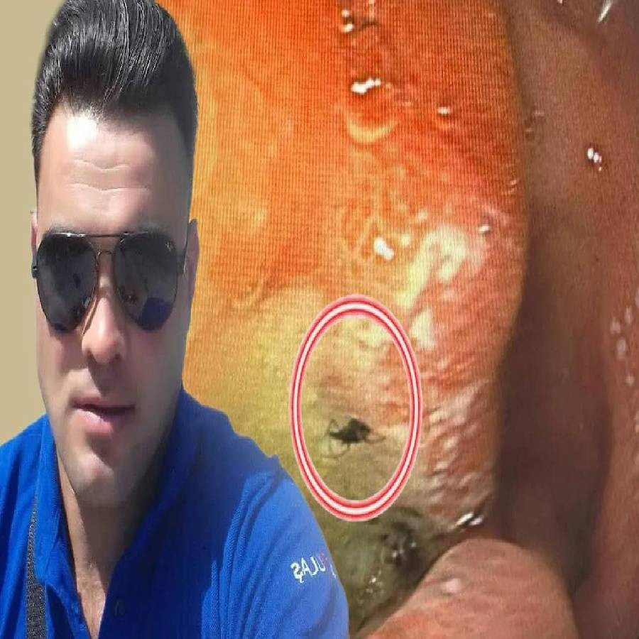 Ağrı şikayetiyle gittiği doktorda hayatının şokunu yaşadı! Midesinden canlı canlı çıkardılar