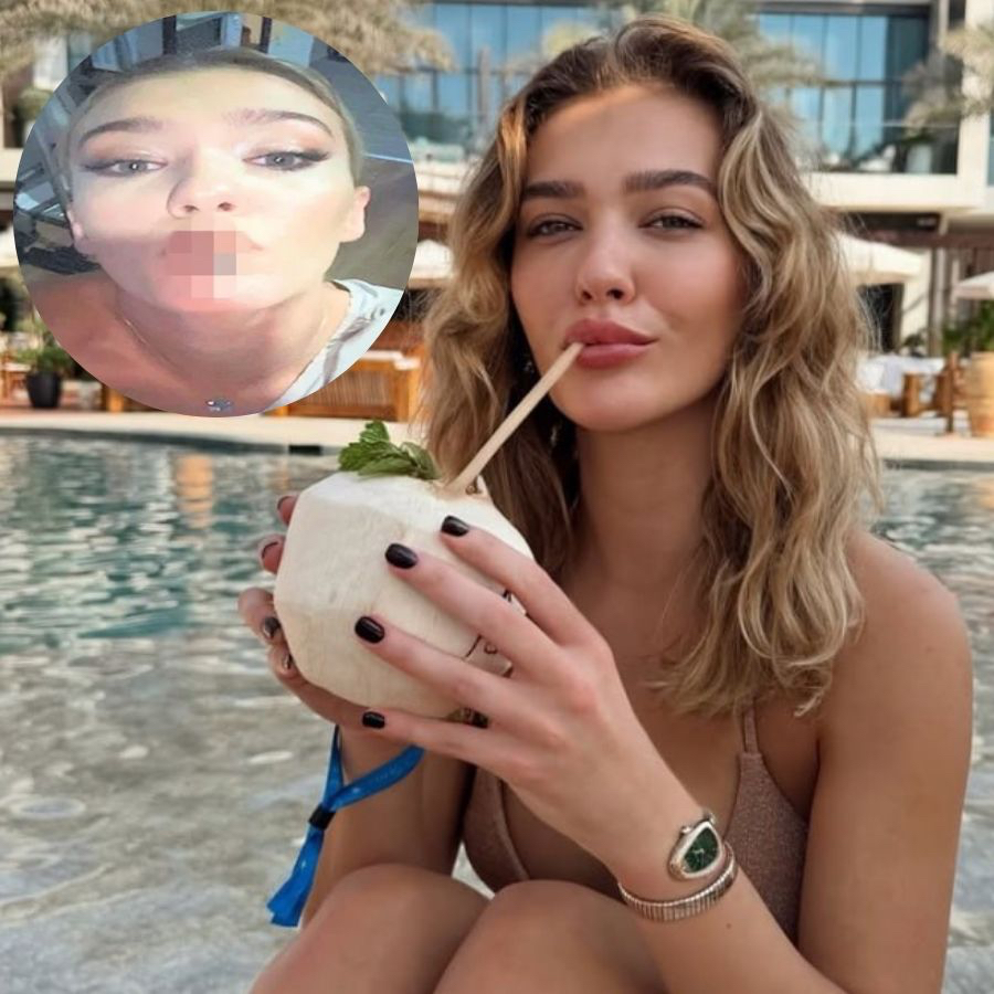 Melisa Döngel'in uyuşturucu kullanırken fotoğrafı ortaya çıktı! İşte oyuncunun uyuşturucu yazışmaları...