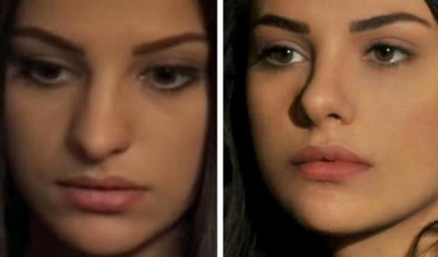 Estetik ameliyatı yaptıran güzel oyuncu eleştirilere sert cevap verdi!