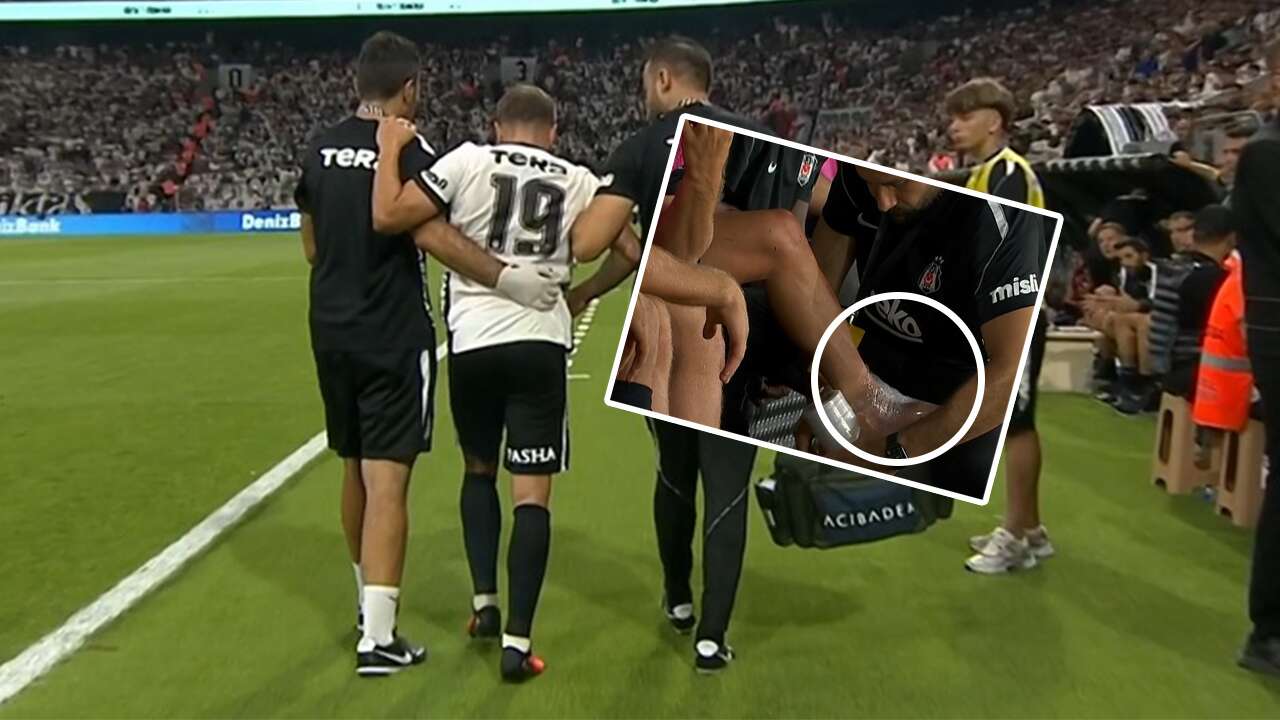 Sakatlanan Trossard'ın son durumu belli oldu