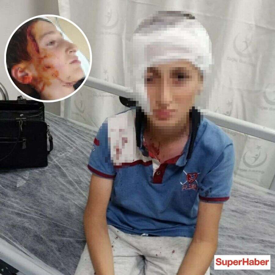 İzmir'de köpek saldırısına uğrayan çocuk için rekor tazminat: Yüzündeki 12 santimetrelik izin bedeli...