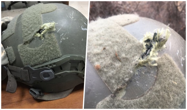 Tunceli'de PKK mermisi yaptı bu izi! 3 parmak aşağısı "Şehadetti"