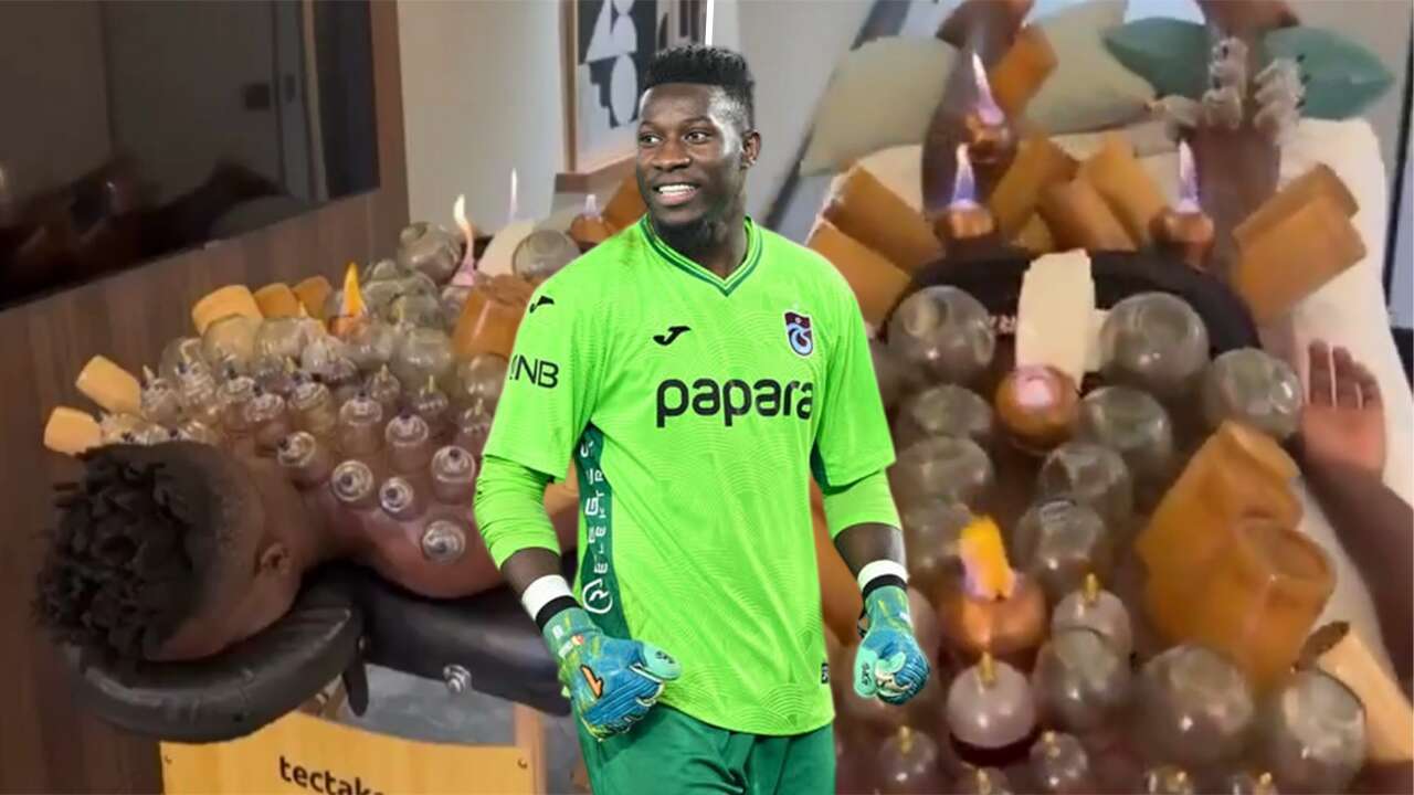 Andre Onana'dan şaşırtan hacamat paylaşımı