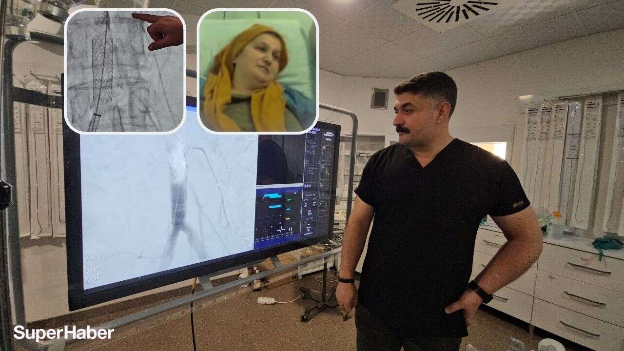 Milyonda bir görülen vaka! Şiddetli öksürük 52 yaşındaki kadının kalp damarını yırttı