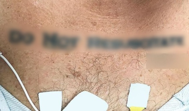 Doktorların dövmesini görmelerinden 1 gün sonra öldü!