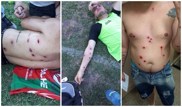 Futbol sahasında dehşete düşüren olay!
